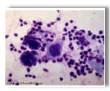 Herpes photos