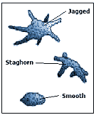 kidney stone shapes
