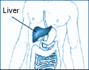 liver disease information