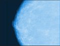 mammogram image